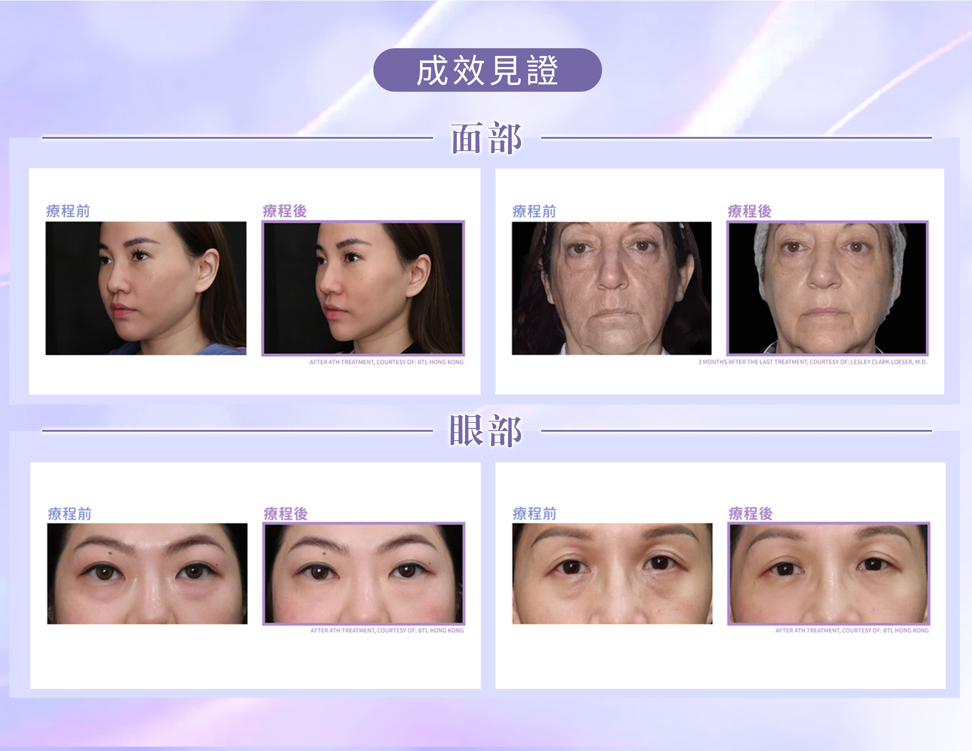 Extra image 5